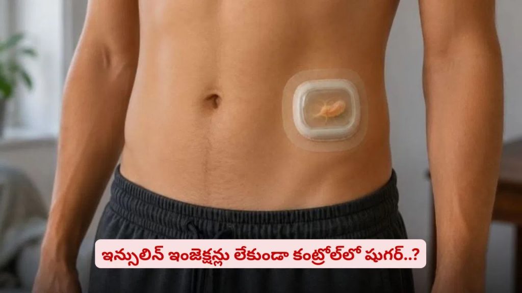 డయాబెటిస్‌ పేషెంట్లకు గుడ్‌న్యూస్‌..! ఇన్సులిన్ ఇంజెక్షన్లు లేకుండానే కంట్రోల్‌లో షుగర్‌‌